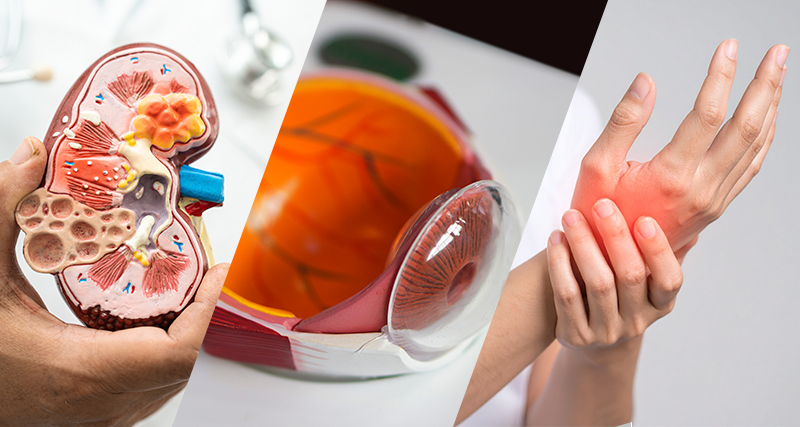 合併症のイメージ